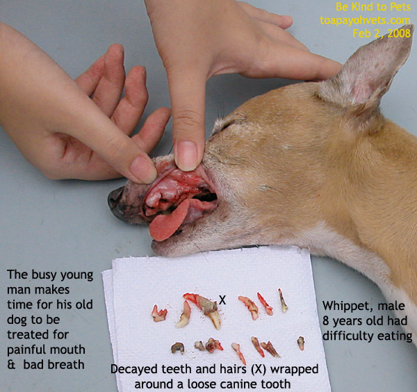 Tumours With Hair And Teeth. loose teeth dropping out.