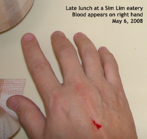 Blood materialises on the hand.
